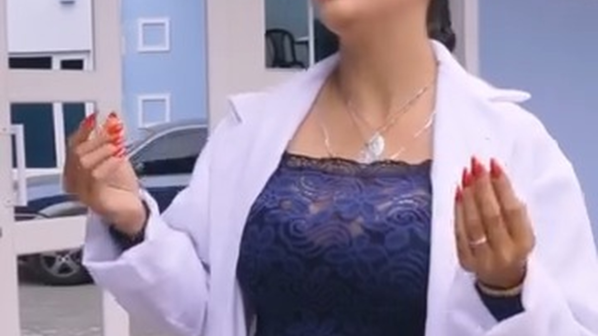 L1303005 Se opera el rostro para ser modelo y su novia no lo reconoce 😱 part2